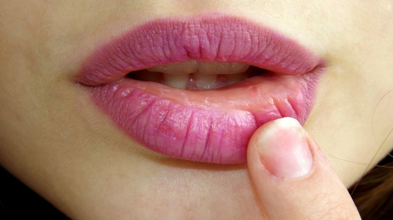 4 Wege zu vollen, sinnlichen Lippen!