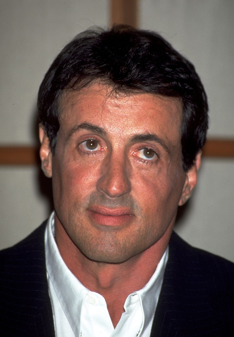 Auch Männer, wie Sylvester Stallone, legen sich hin und wieder unter's Messer.