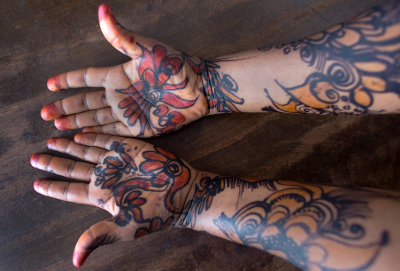 Eine Frau ließ sich ein Henna-Tattoo stechen und hatte danach mit einem Ausschlag zu kämpfen, der dauerhaft Narben hinterließ