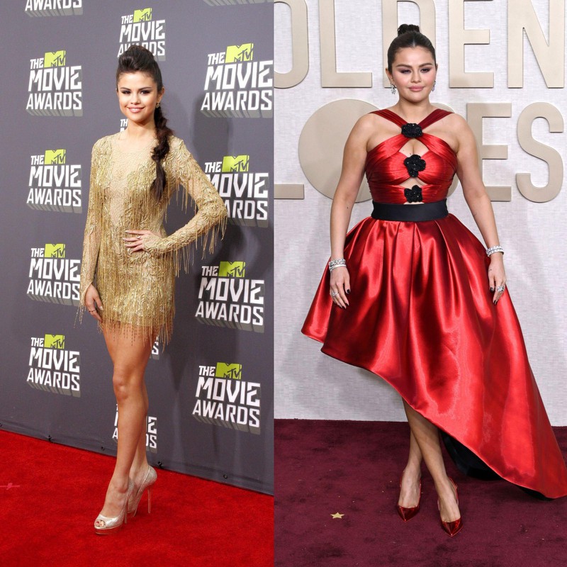 Selena Gomez hat aufgrund ihrer Erkrankung in den letzten Jahren mit Gewichtsschwankungen zu kämpfen