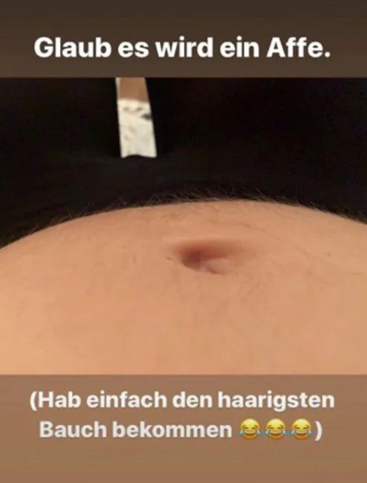 Model Marie Nasemann teilte während Schwangerschaft Nr. 1 ein Foto ihres behaarten Babybauchs.