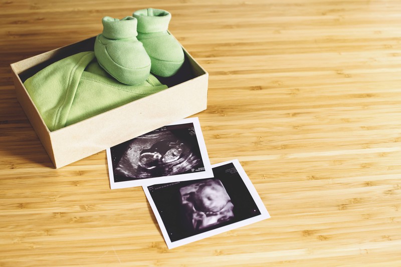 Zwei Ultraschallbilder, die neben einer Box mit Babyschuhen und einem Body liegen.