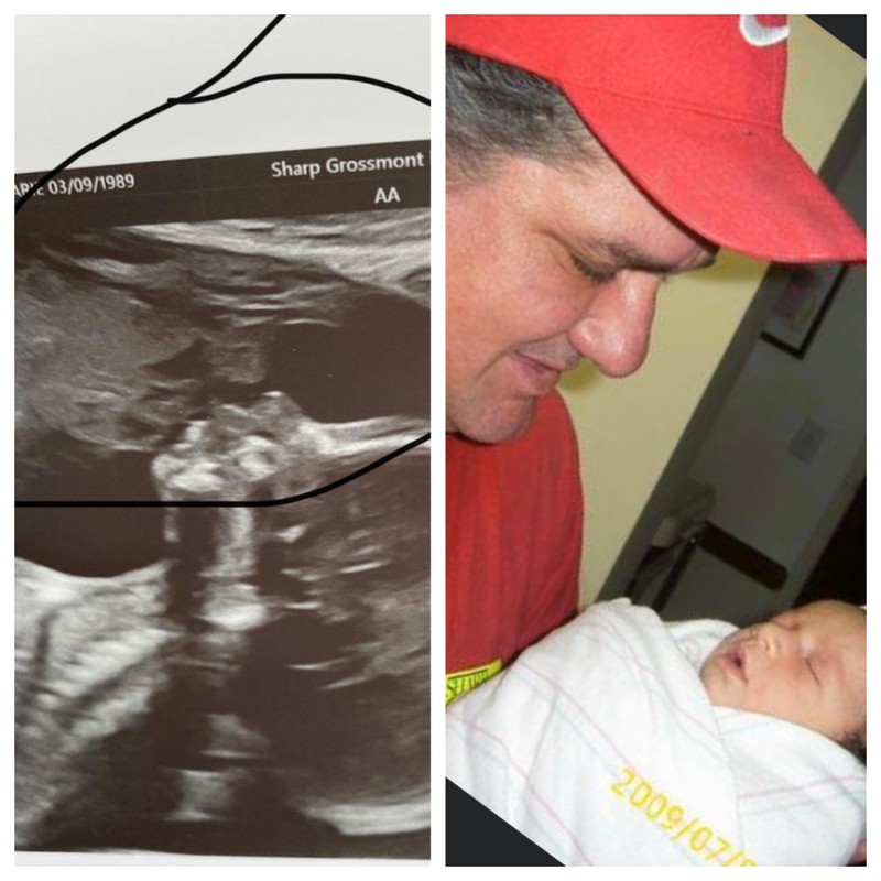 Auf dem Ultraschallbild sieht es so aus, als würde ein Mann den Säugling küssen.