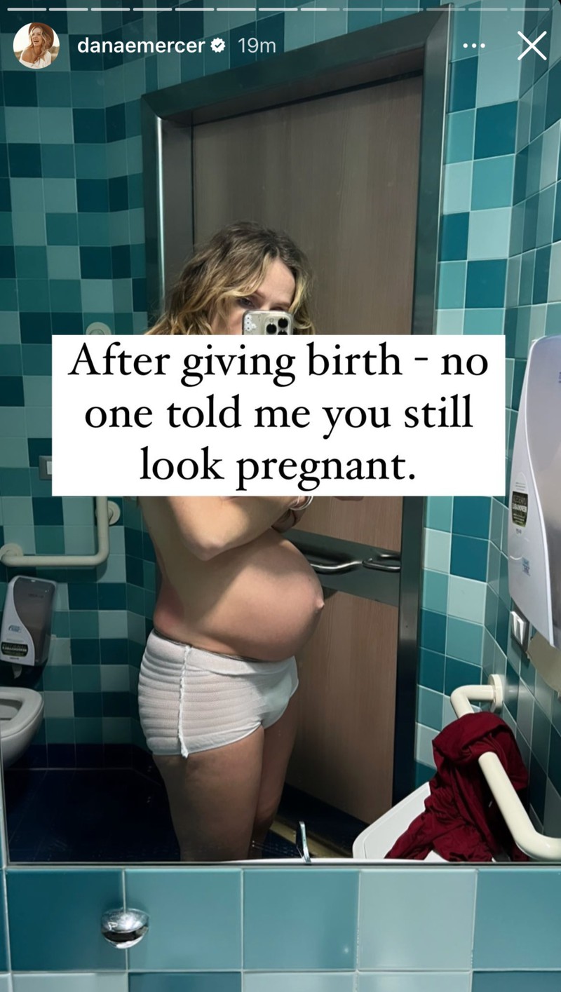 Nach einer Schwangerschaft geht der Babybauch nicht direkt wieder zurück