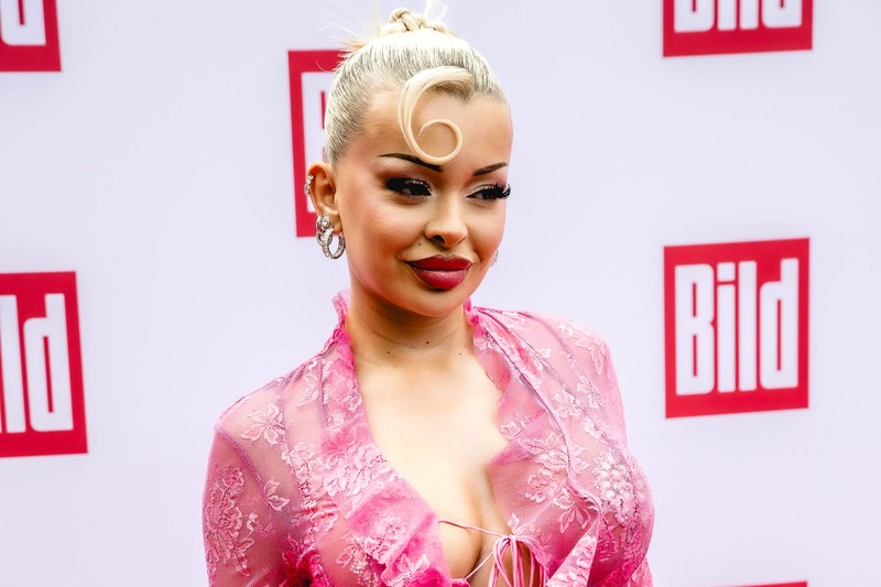 Diese Schönheits-OP hätte Katja Krasavice fast das Leben gekostet.