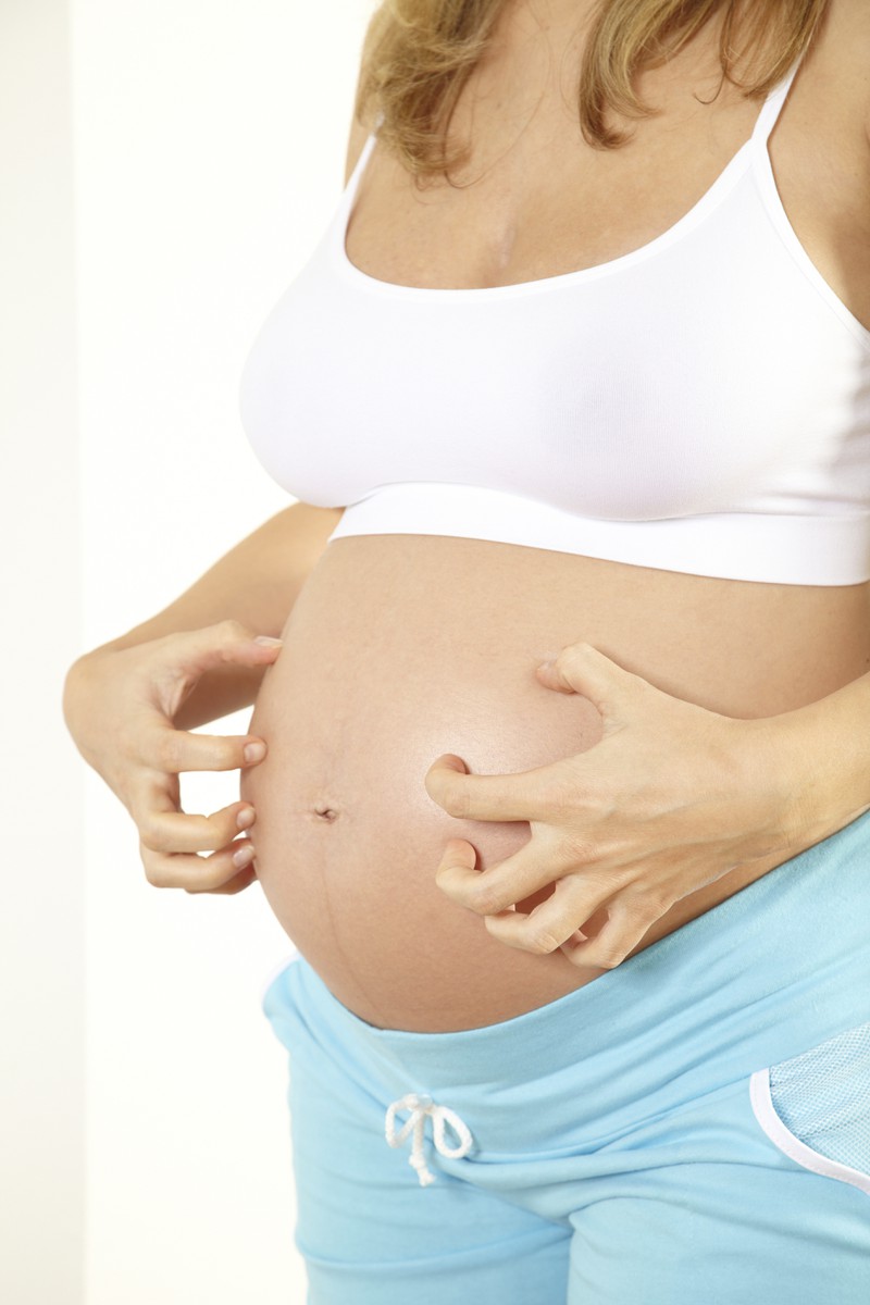 Der Juckreiz kann in der Schwangerschaft ziemlich ätzend sein