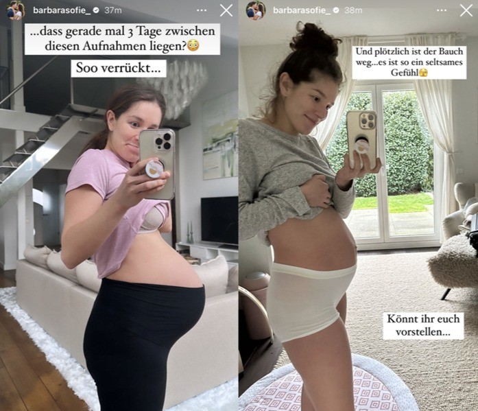 Eine Schwangerschaft verändert den Körper sehr. Schon kurz nach der Geburt ist der Bauch oft viel kleiner