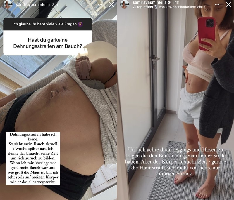Samira Klampfl zeigt offen ihren Bauch nach der Schwangerschaft.