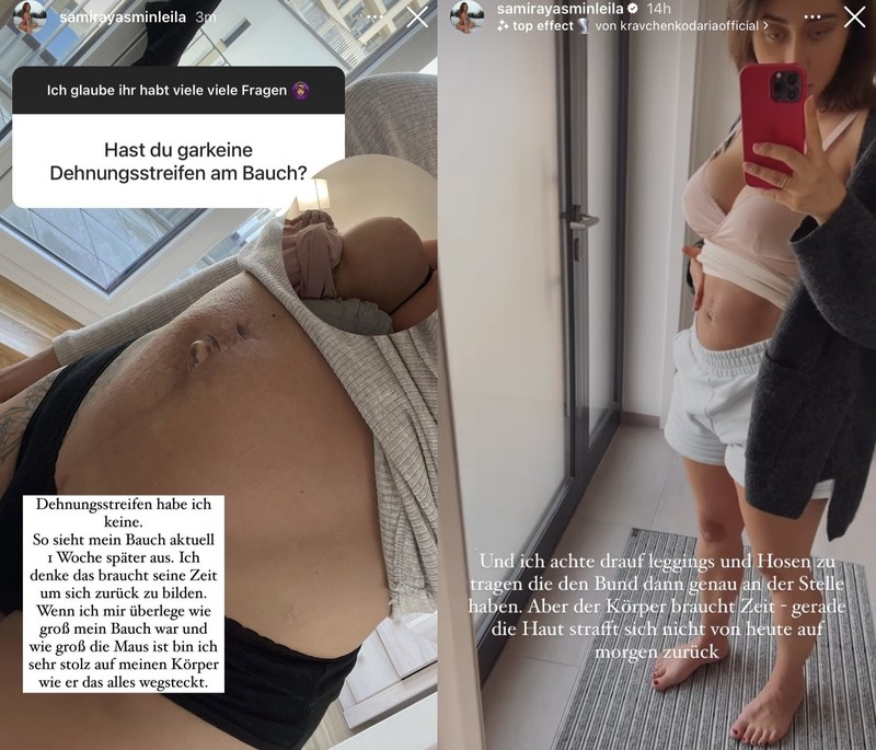 Samira Klampfl zeigt offen ihren Bauch nach der Schwangerschaft.