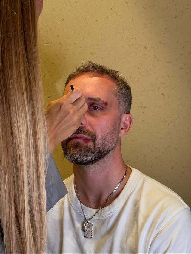 Mark Forster zeigt sich erstmalig ohne Cap.