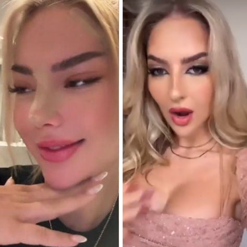 Emma Fernlund zeigt nach OP ihr neues Gesicht.