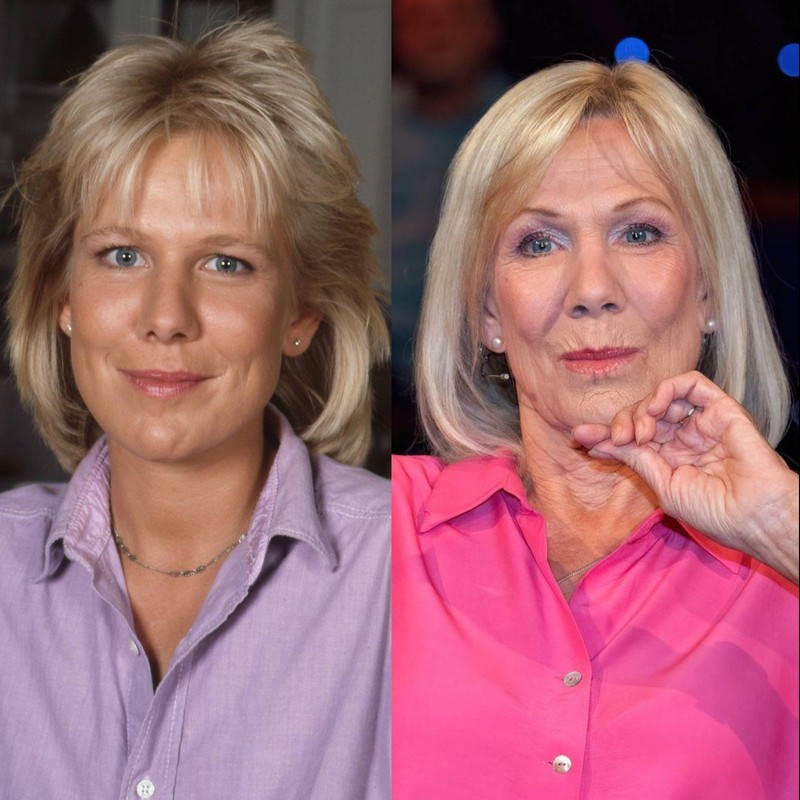 Ulrike von der Groeben beichtete einen einmaligen Schönheitseingriff.