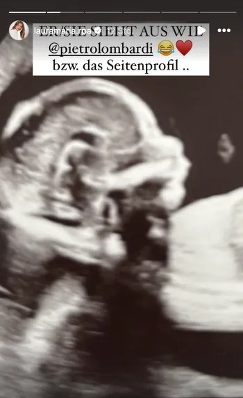 Laura Maria zeigt Ultraschallbild ihres ungeborenen Kindes.