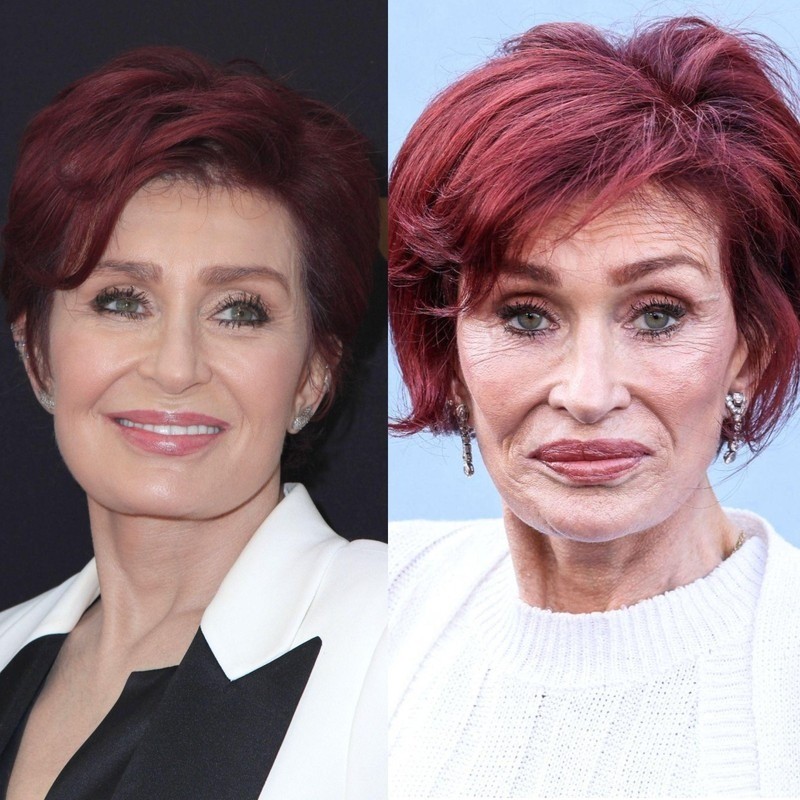 Sharon Osbourne gab 2023 offen zu, Ozempic genommen zu haben, und sagte, sie habe nun Probleme, wieder zuzunehmen.
