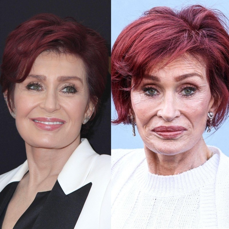 Sharon Osbourne gab 2023 offen zu, Ozempic genommen zu haben, und sagte, sie habe nun Probleme, wieder zuzunehmen.