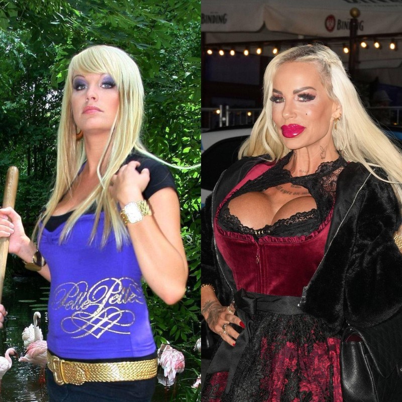 Gina-Lisa Lohfink ist bekannt dafür, offen über ihre Schönheitsoperationen zu sprechen.