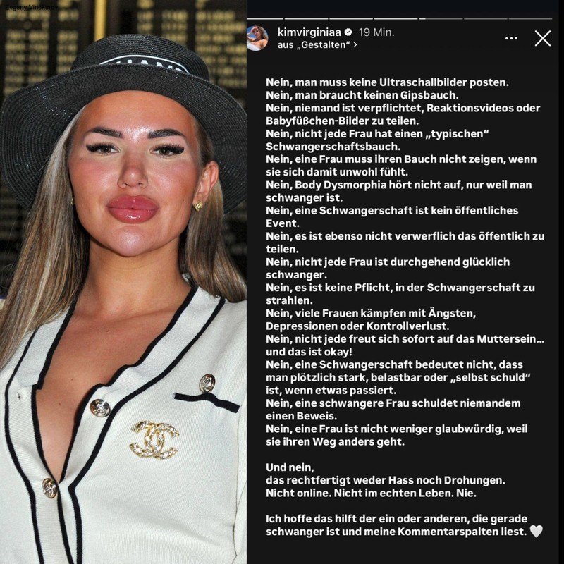 Kim Virginia Hartung teilt Statement zu ihrem Umgang mit der Schwangerschaft.