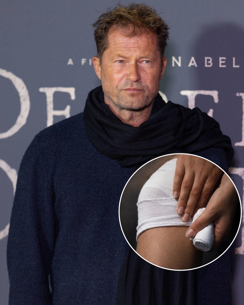 Vor einer Sepsis bleiben auch Promis nicht verschont. So auch Til Schweiger.